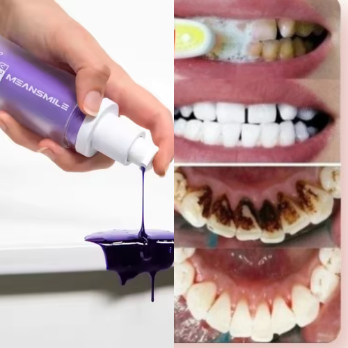 MEANSMILE v43 :Correcteur de Couleur pour des Dents Plus Blanches